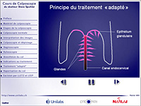 internet web agence - Formation au traitement du papillomavirus